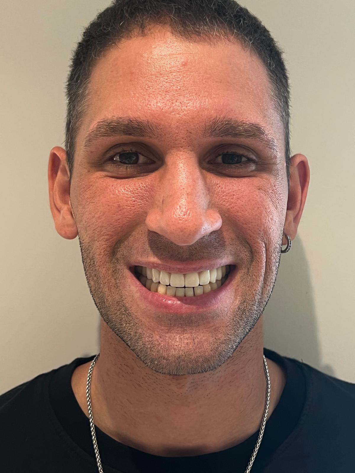 ECE Dental Patient Result